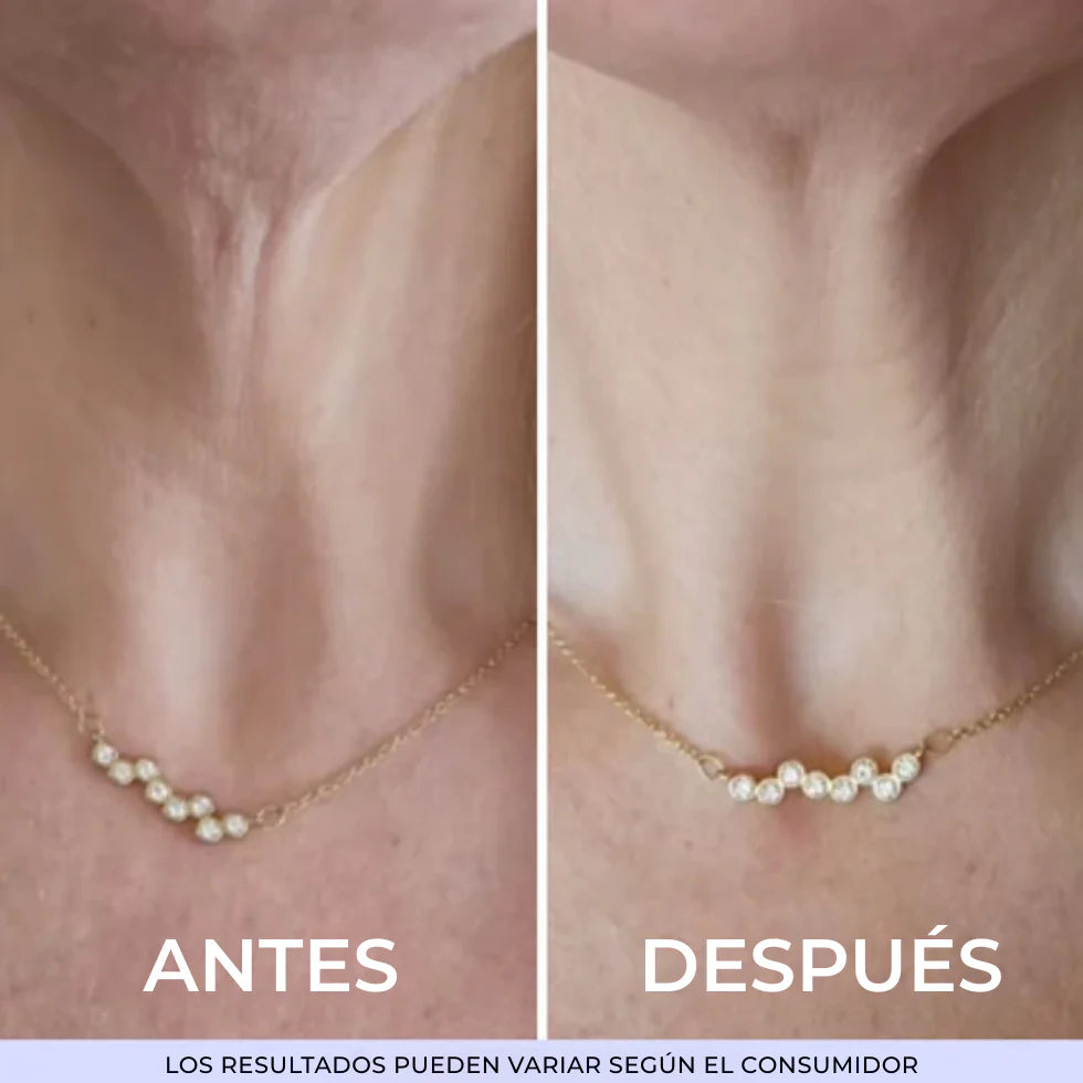 GOPURE | PROMOCION 2X1 🎁 - Crema Reafirmante y Lifting para el Cuello