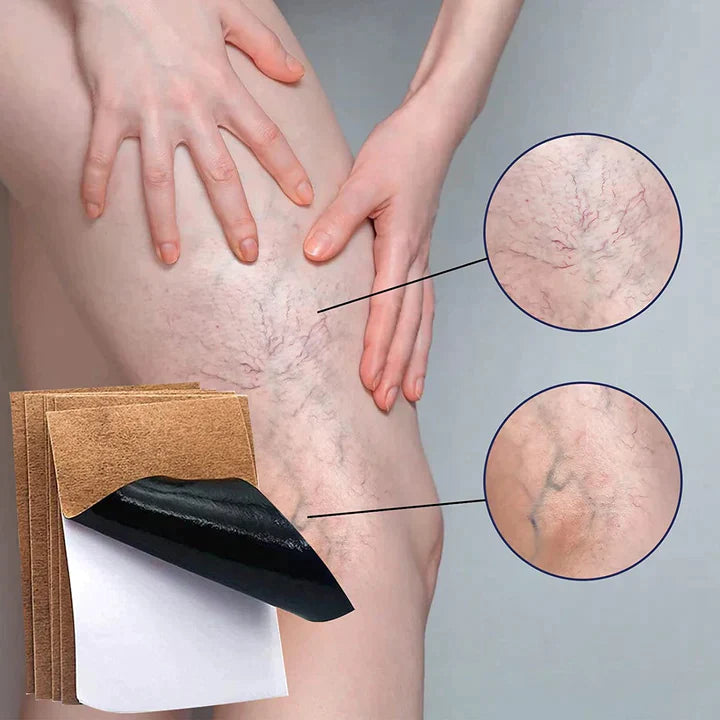 Varipro™ - Parche para Varices ( PACK 10 UNIDADES ) 🎁ESPECIAL CYBERDAYS 2x1🎁