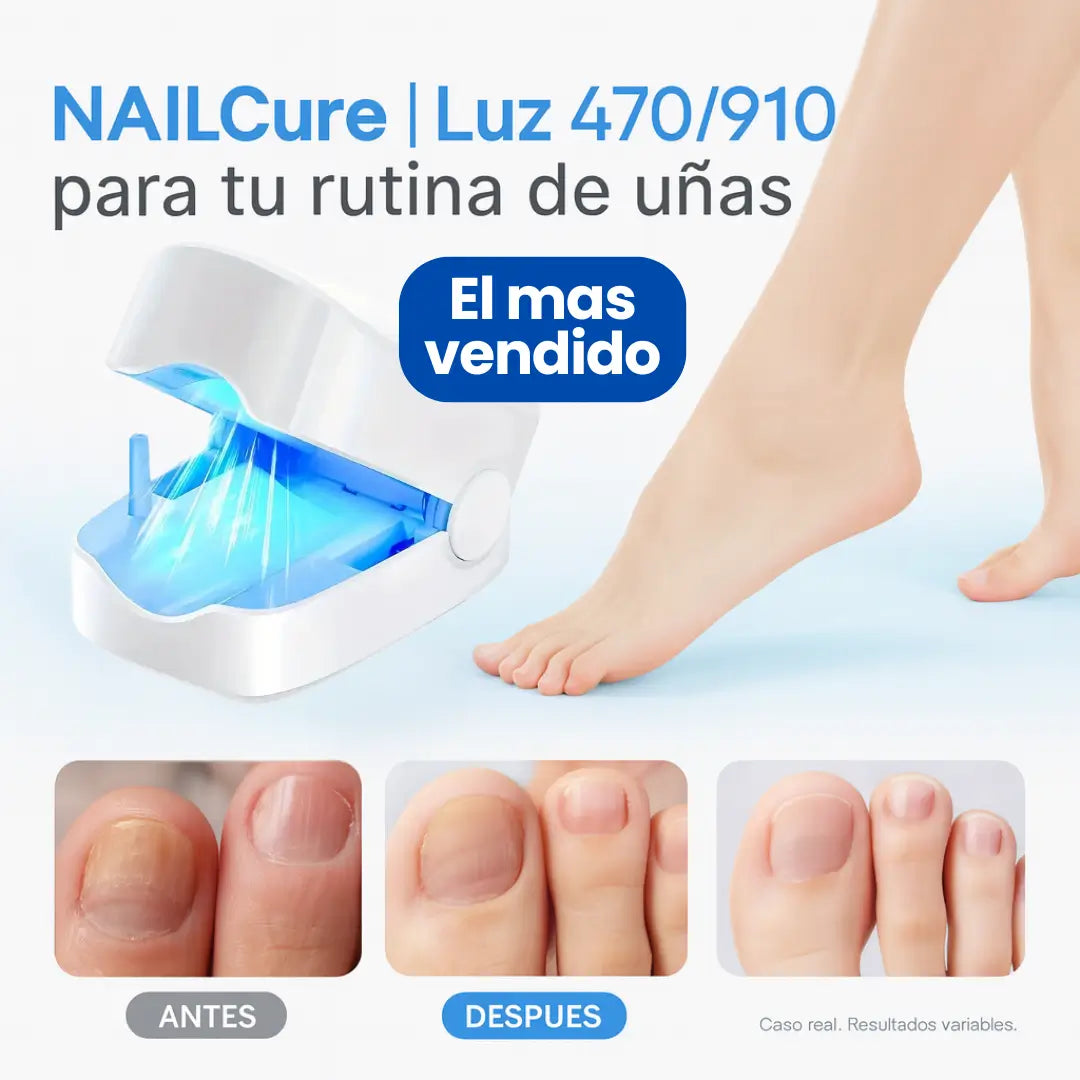 Dermolux® (Dispositivo láser para tratamiento de hongos en las uñas)