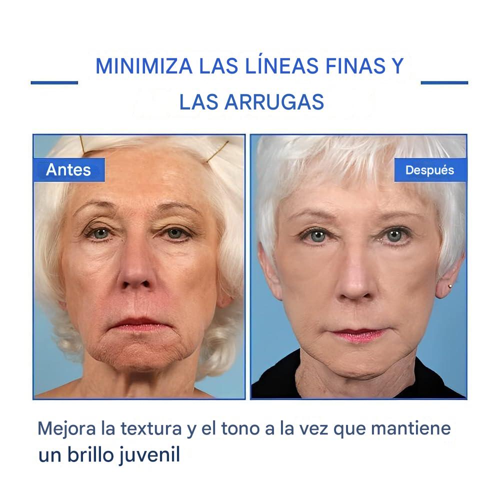 💧BOTOX LIQUIDO💧