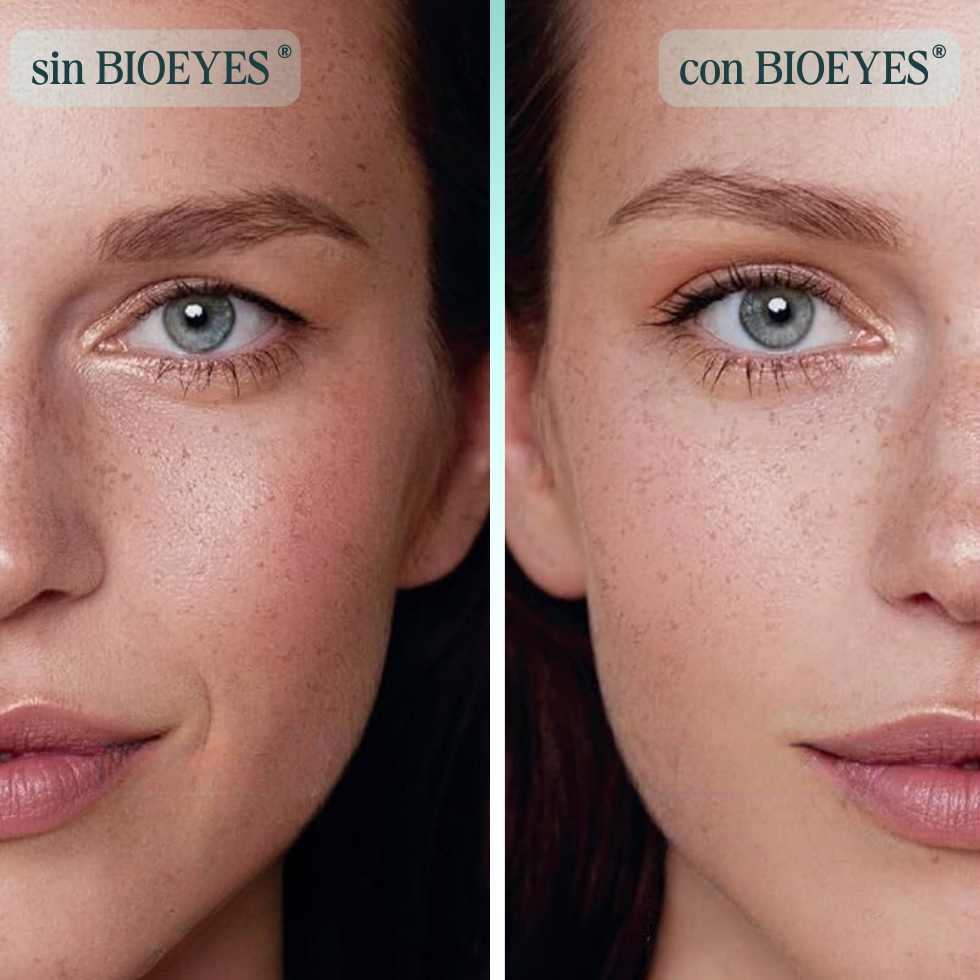 BIOEYES® KIT LEVANTA PÁRPADOS