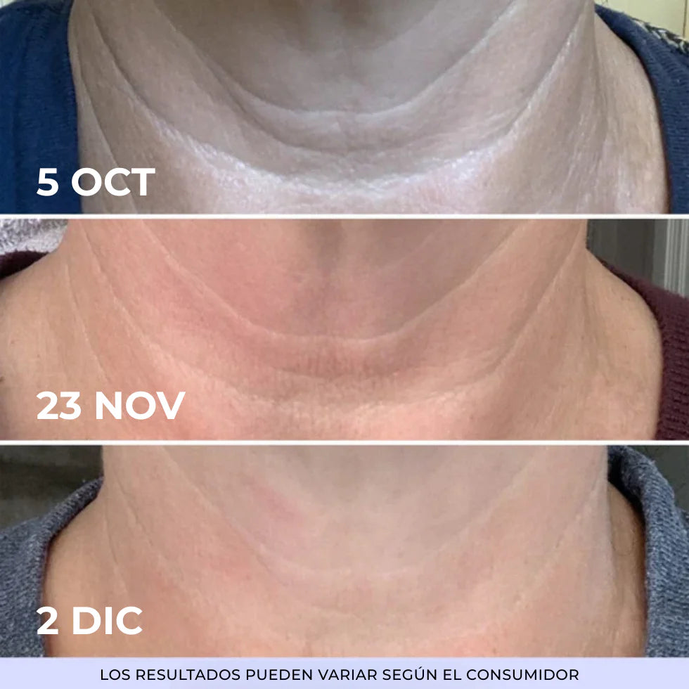 1+1 GRATIS GOPURE | Crema Reafirmante y Lifting para el Cuello