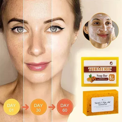 Jabón Despigmentante Natural Con Cúrcuma - NaturaBloom®  SOLO POR HOY 3X1