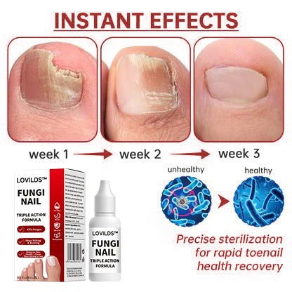 LOVIDS™ Toenail Fungus Treatment | Triple-Action Repair Formula-Plant-Based Formula | FDA-Registered