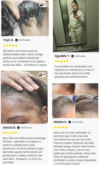 Vitaorganic crecimiento del cabello en 15 días😍🔥LLEVA EL 2DO CON UN 50% DE DESCUENTO🔥🔥