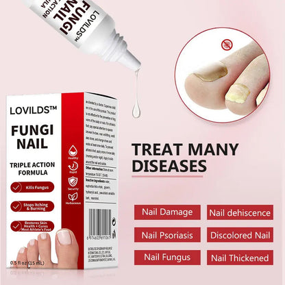 LOVIDS™ Toenail Fungus Treatment | Triple-Action Repair Formula-Plant-Based Formula | FDA-Registered