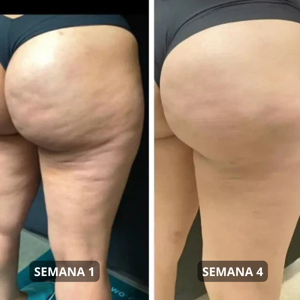 Aceite Anticelulítico para Masajear