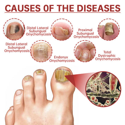 LOVIDS™ Toenail Fungus Treatment | Triple-Action Repair Formula-Plant-Based Formula | FDA-Registered