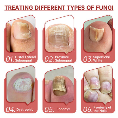 LOVIDS™ Toenail Fungus Treatment | Triple-Action Repair Formula-Plant-Based Formula | FDA-Registered