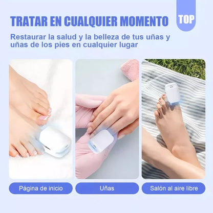 Dermolux® (Dispositivo láser para tratamiento de hongos en las uñas)