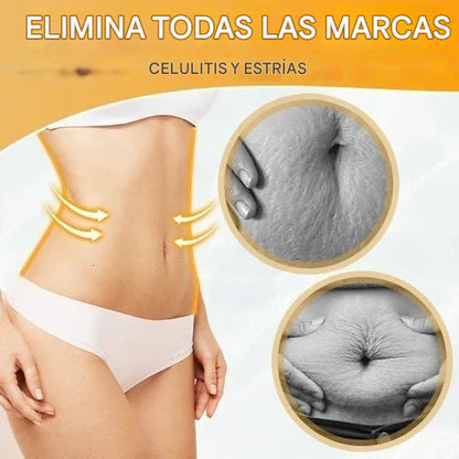BURN® - Aceite Quemador De Grasa + Reafirmante + Drenaje Linfático - SOLO POR HOY 2X1